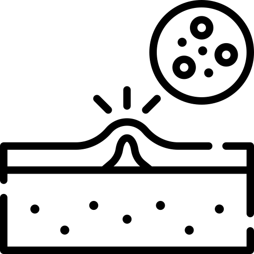 Trądzik