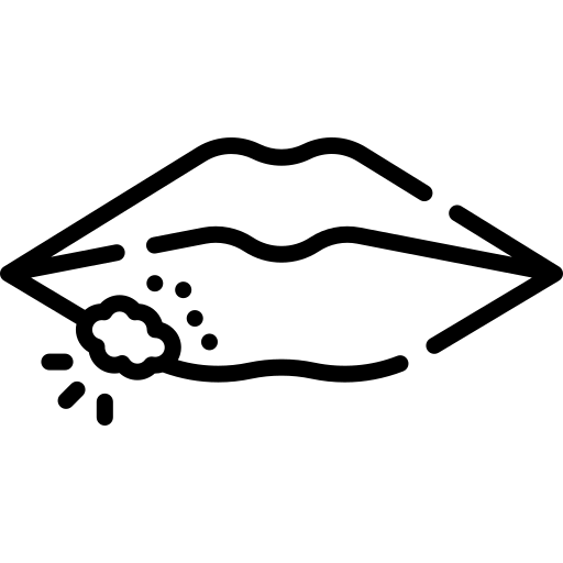 Opryszczka